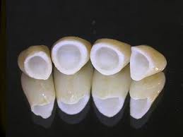 CORONAS ZIRCONIO DESDE   $ 590.0000